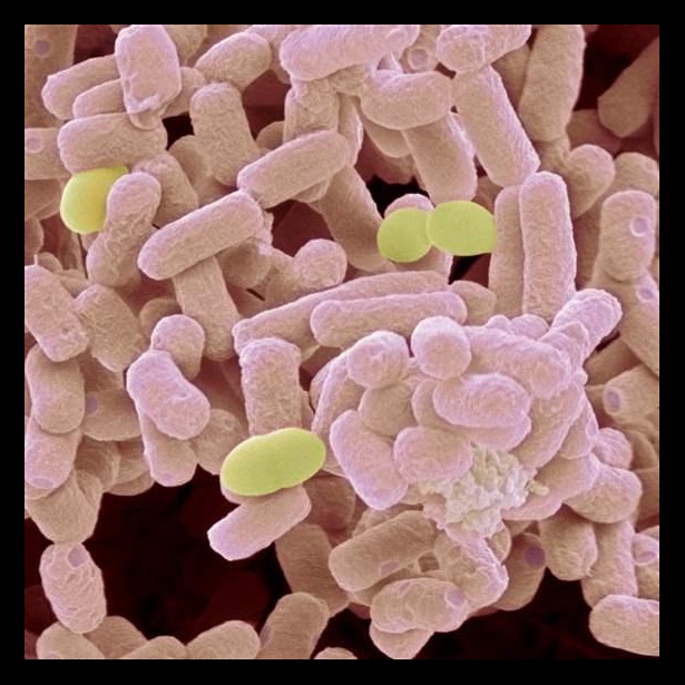 E. Coli bacteria