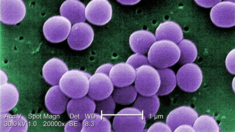 Staphylococcus