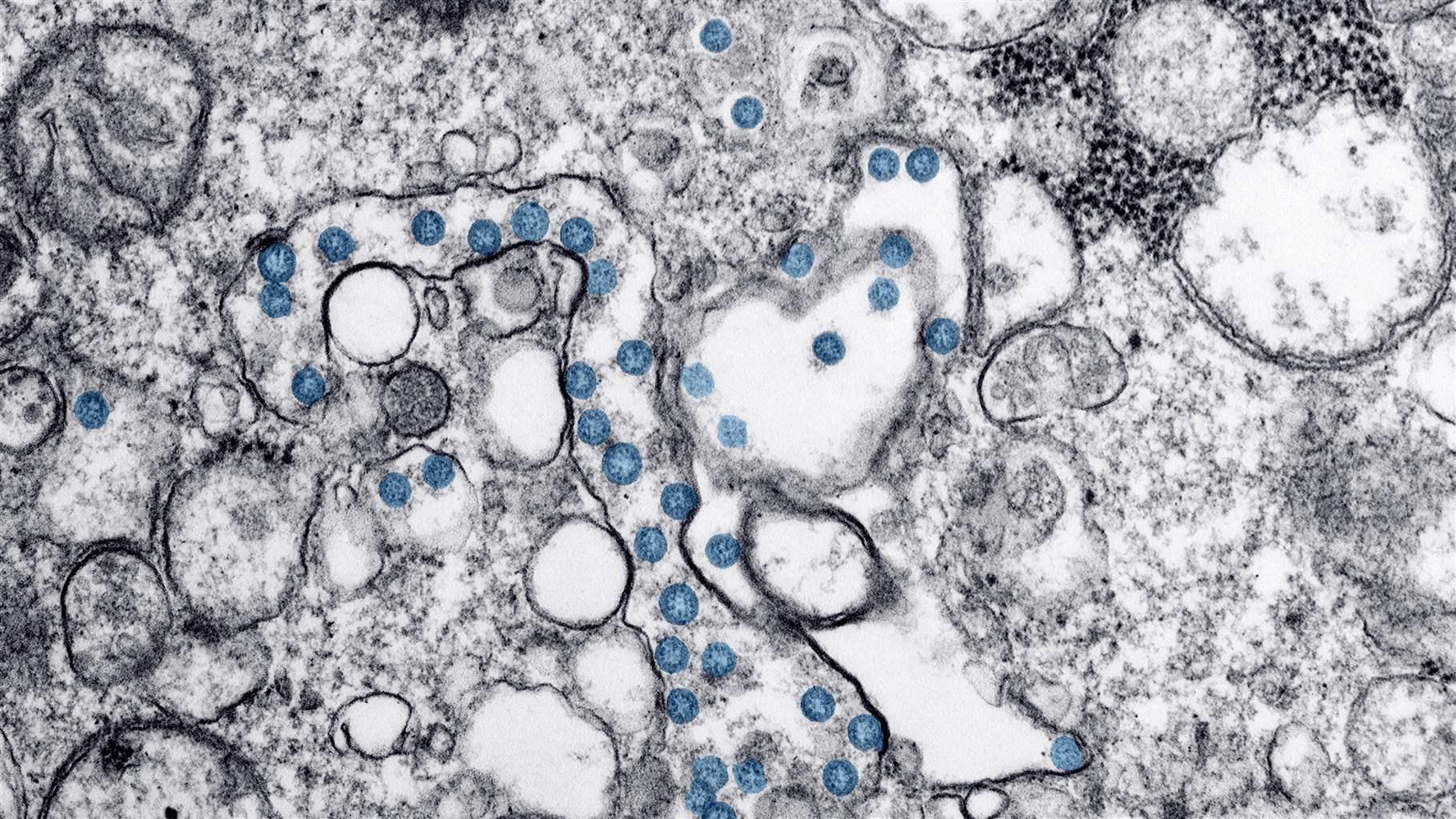 Transmission electron microscopic image of an isolate from the first US case of COVID-19, formerly known as 2019-nCoV, a coronavirus, March, 2020.