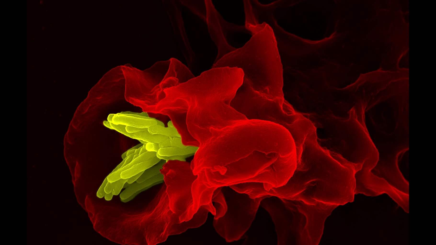 Macrophage (red) engulfing tuberculosis bacteria (yellow), taken with ZEISS FE-SEM.