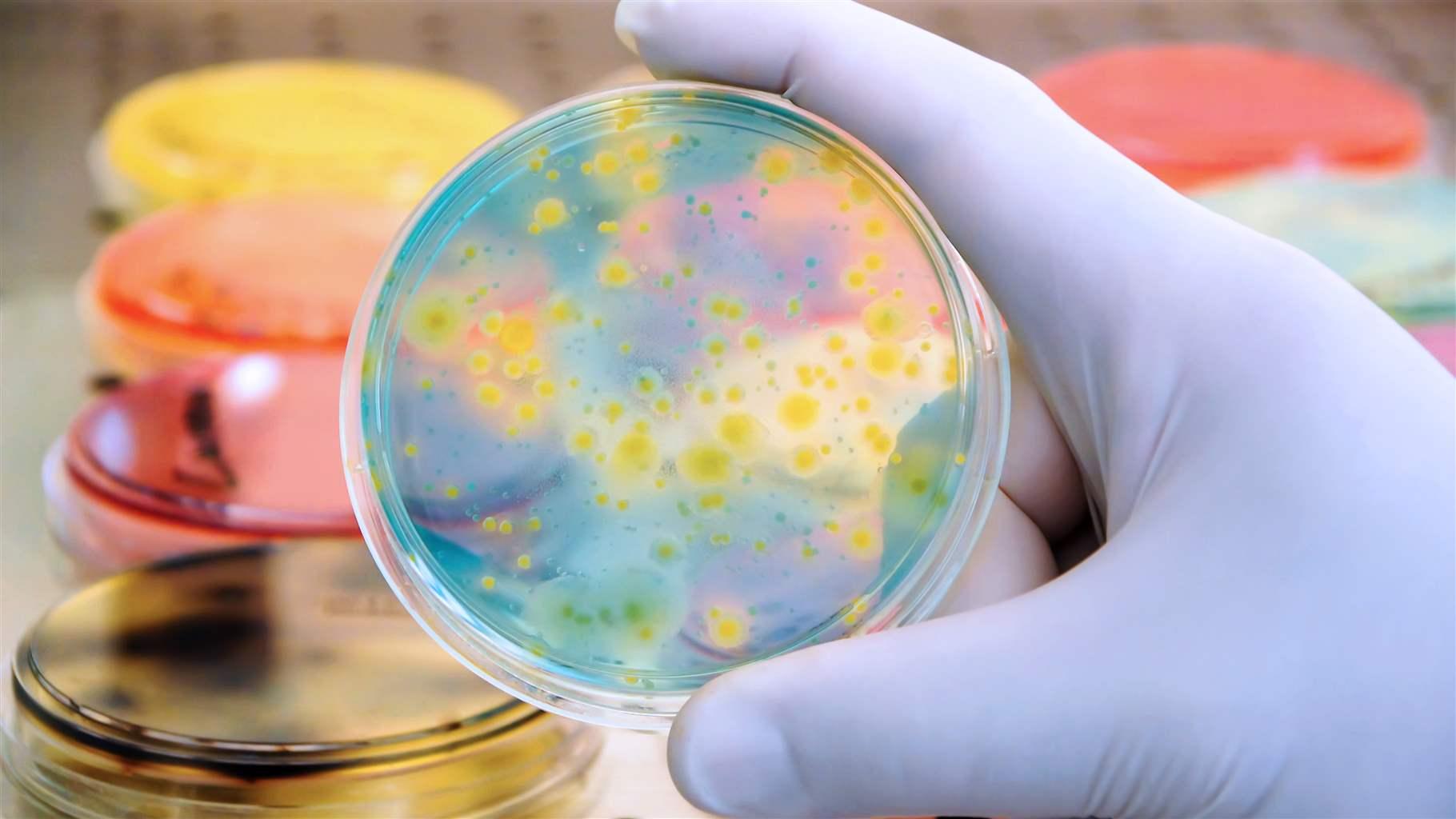 Bacterial colonies culture Bacterial colonies culture