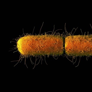 Computer illustration of an orange e.coli