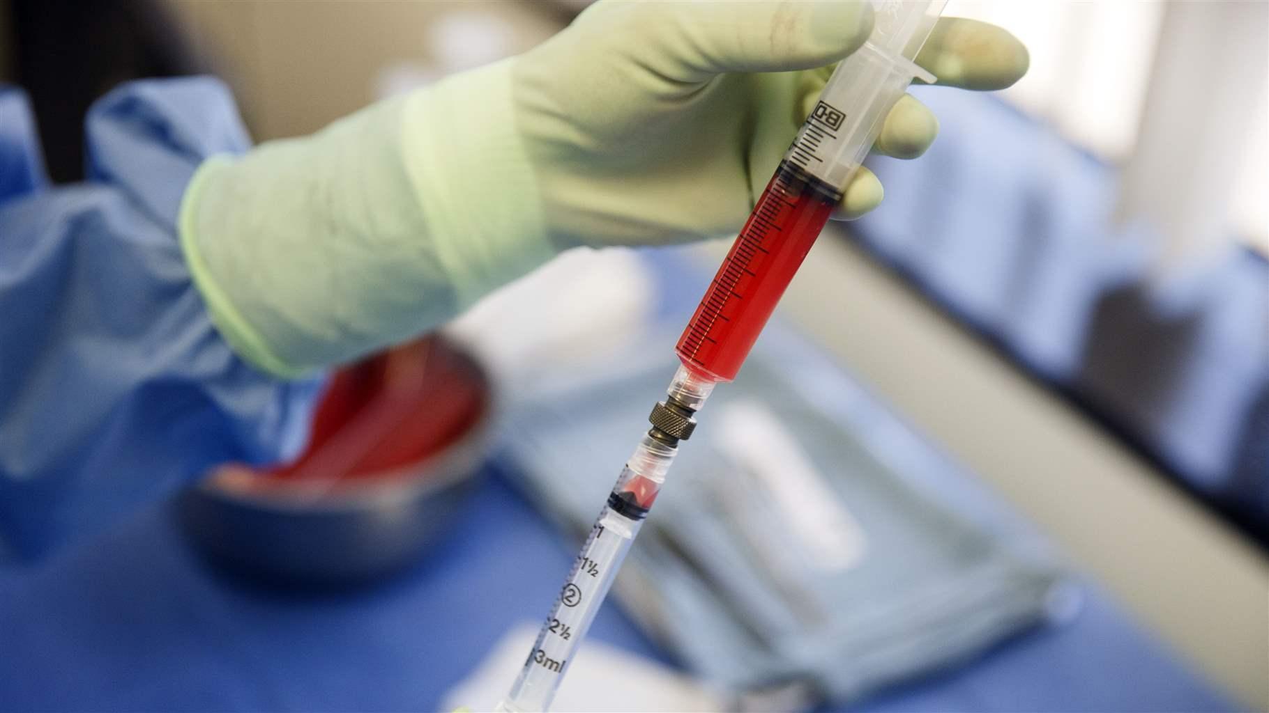  Assistant Audrey Fianza doses from a syringe cells prepared for stem cell therapies for a patient after being spun in the "Time Machine" centrifuge in the office of Dr. Mark Berman on Tuesday, August 16, 2016 in Beverly Hills, CA