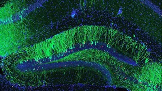 : A wave-like web of fluorescent green brain cells, dotted with the occasional red cell, are spread in curvy lines across a dark blue background. 